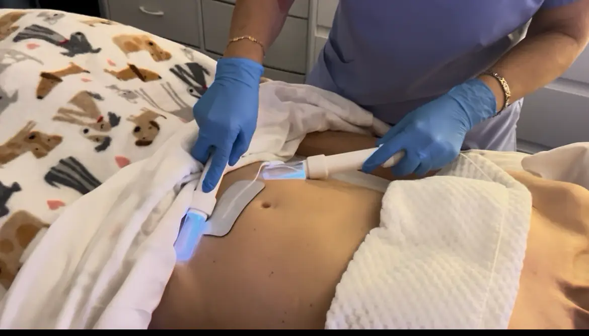 lymphatic enhancement therapy